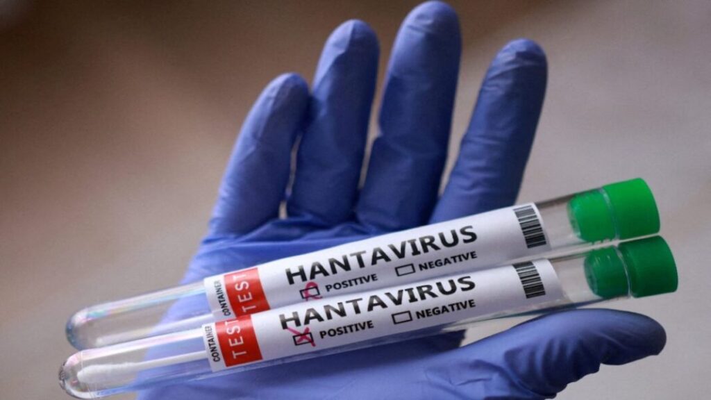 Confirman tres fallecidos por Hantavirus en Anzoátegui